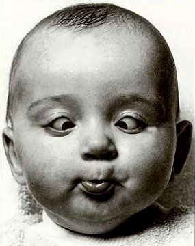 斜視的危害，遠(yuǎn)不只是難看