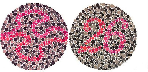 眼睛有色盲癥會(huì)是什么感覺(jué)？