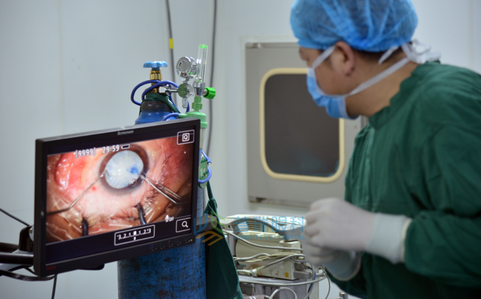 文字版，白內(nèi)障手術(shù)過程要看看哦