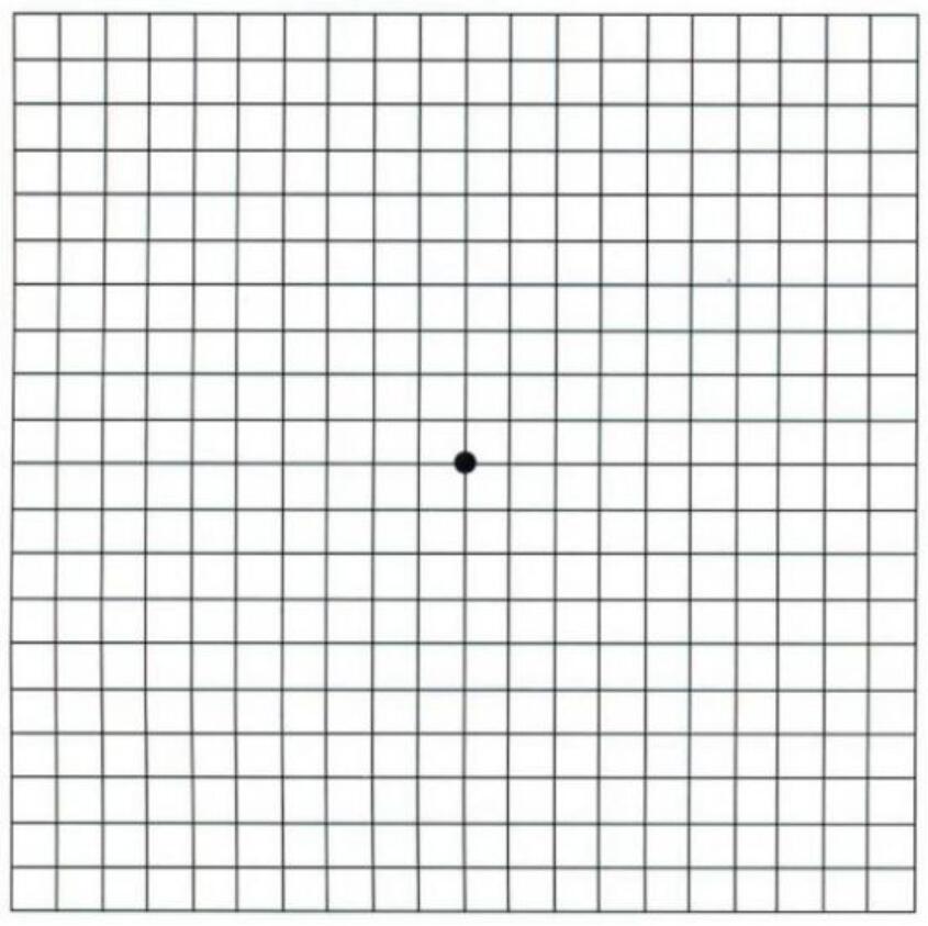 知道嗎？熬夜多了，你的眼睛也就“黃了”  很多年輕人為了