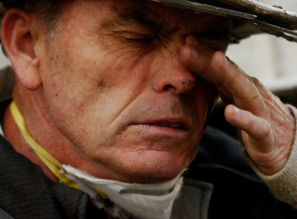 得了白內(nèi)障眼睛會疼痛嗎?