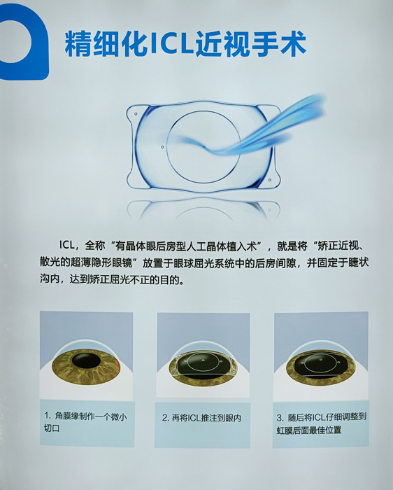 寒假摘鏡總動(dòng)員，近視朋友的三種矯正近視方式