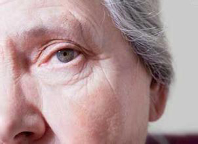 陽(yáng)春三月白內(nèi)障好時(shí)節(jié)，了解相關(guān)癥狀，別被忽悠了