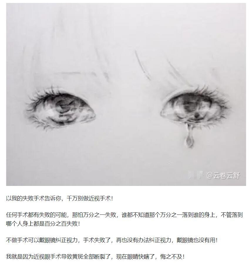 教你，怎樣去了解近視手術(shù)  